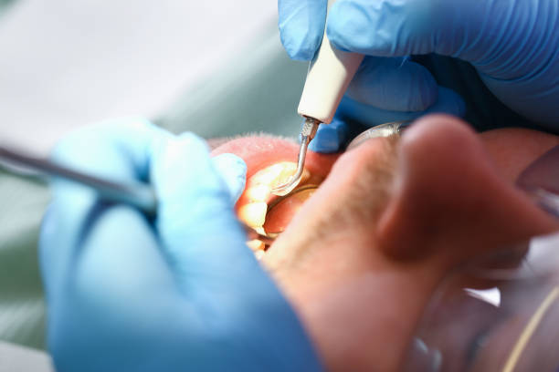 Best Emergency Dental Care for Abscessed Tooth in Barnesville, GA