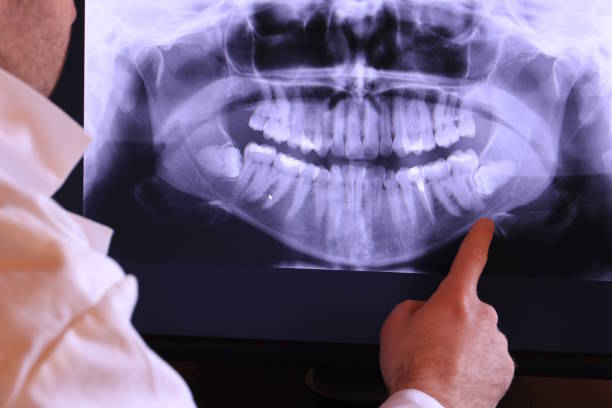 Best Orthodontic Emergency Dentist in Barnesville, GA