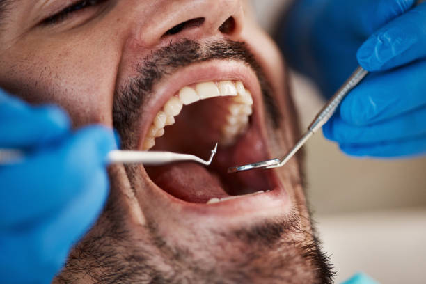 Best Broken or Cracked Tooth Emergency Dentist in Barnesville, GA